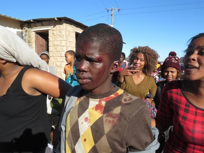 Bleeding teen forced to confess
