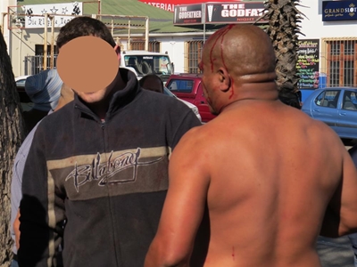Opvolg: Man met gholfstok geslaan