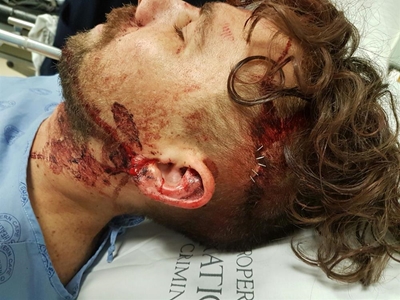 Man met bottels en bakstene aangeval