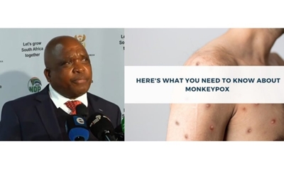 How does the monkeypox virus spread?