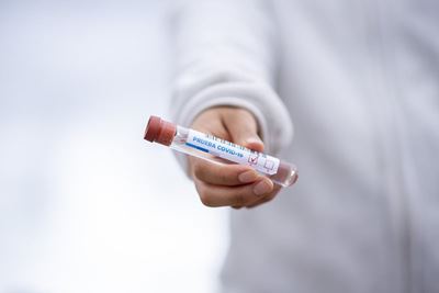 Gauteng health department to conduct Covid-19 antibody survey