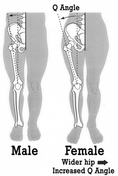 Knee injuries: Patella dislocation