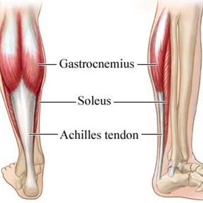 injury to the achilles tendon george herald