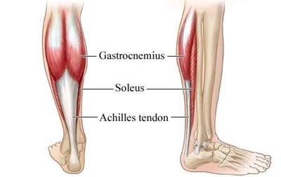 Injury to the Achilles tendon