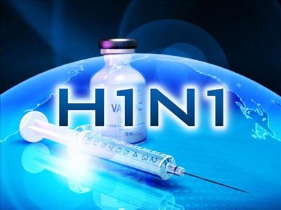 Swine flu scare at George company