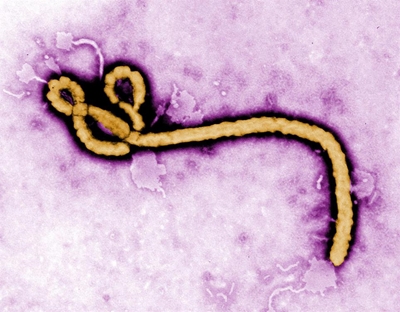 The Ebola virus can be prevented
