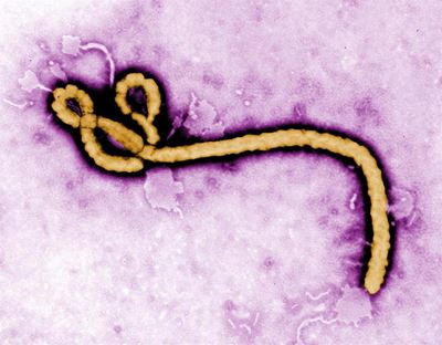 The Ebola virus can be prevented