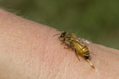 First aid for bites and stings: Part 1
