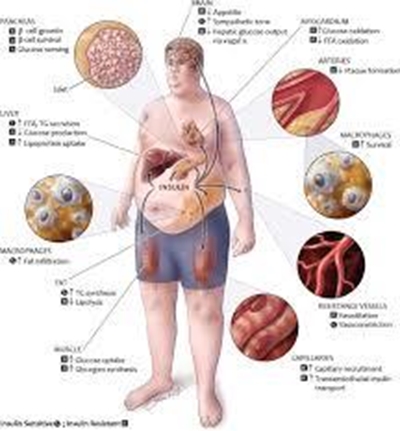 What is metabolic syndrome?