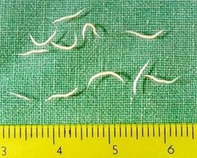 Understanding pinworms and pinworm infections - part 1