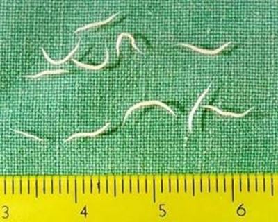 Understanding pinworms and pinworm infections - part 1