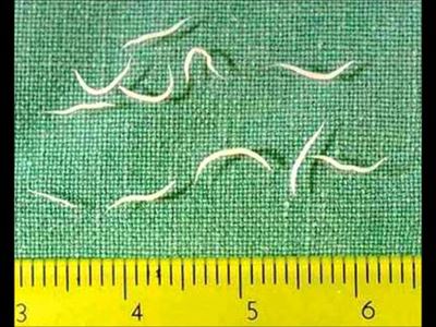 Understanding pinworm infection