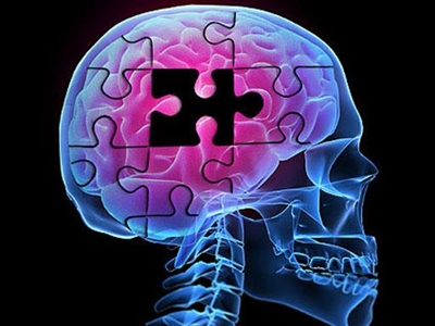 Alzheimer's warning signs