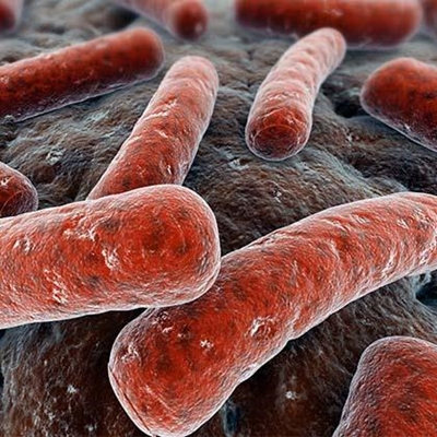How to recognise TB