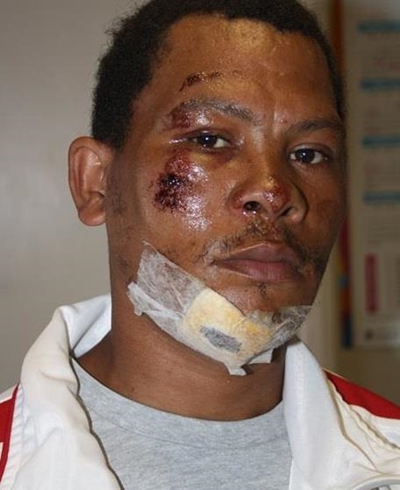 Cyclist hit by truck on N2