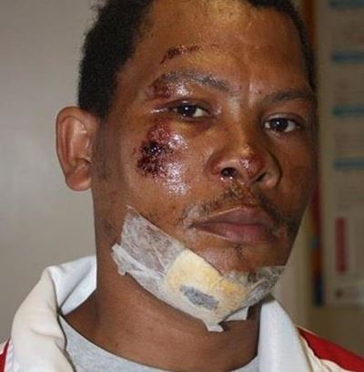 Cyclist hit by refuse truck on N2