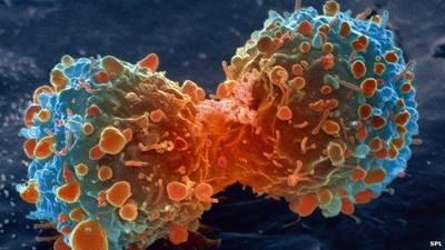 Screening and diagnosing cancer in the laboratory