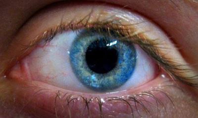 What is an eye stroke?