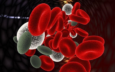 What is hemochromatosis?