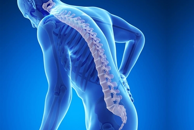 Osteoporosis is a silent disease
