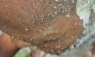 Grass cutter hospitalised after bee attack in KZN