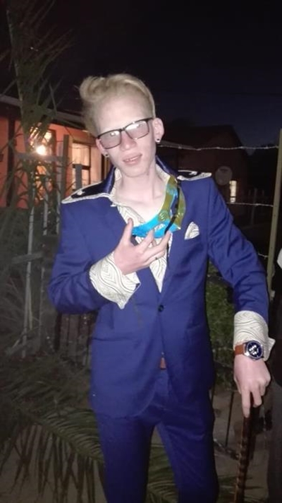 Albino laat hom nie onderkry