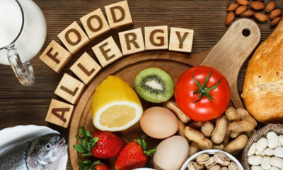 5 food allergy questions you need to know the answer to