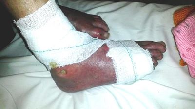 Dogter van Alzheimer-lyer soek verduideliking