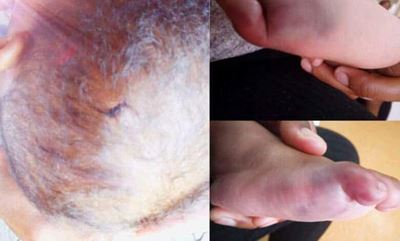 Baby allegedly beaten at Mamelodi Regional Hospital