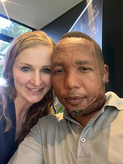 'n Nuwe gesig en vooruitsig vir Melvin