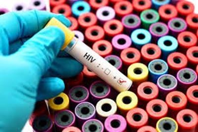 Scientists take ‘huge step forward’ for finding HIV cure