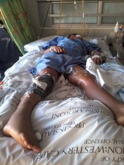 Boy savaged by dogs