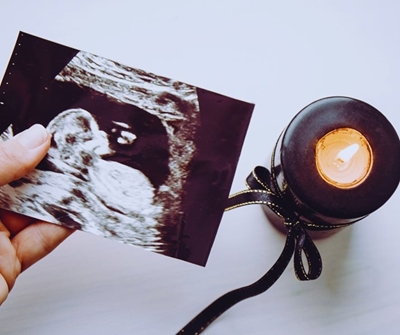 Abnormal bleeding during and after pregnancy  