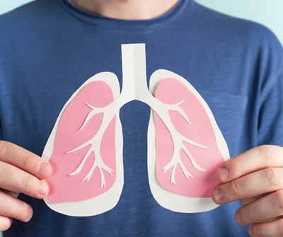  TB crisis in SA: less talk, more action needed to reduce deaths 