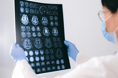 Epilepsy week 2026: What every South African should know 