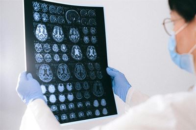 Epilepsy week 2026: What every South African should know 