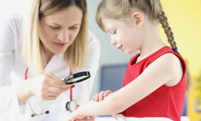 How to treat and control eczema in children