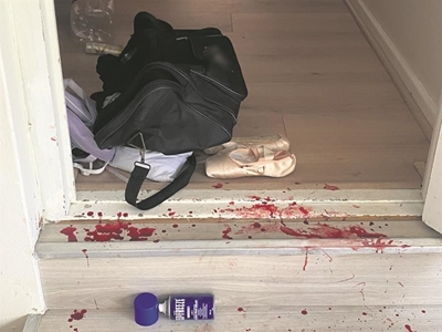 Businessman savagely attacked