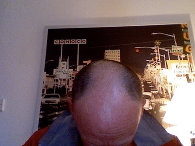 Cure for baldness imminent – study