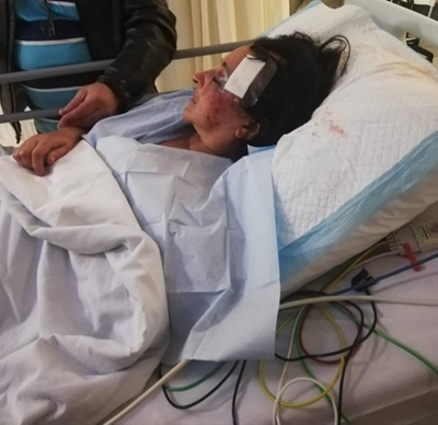 Plett riot victim still in ICU