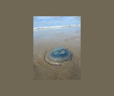 2 744 jellyfish sting cases locally