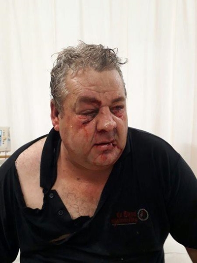 Borgtog vir man na aanranding 