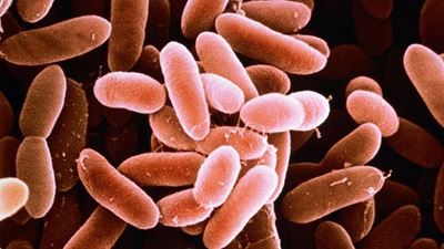 Listeria death toll now at 63