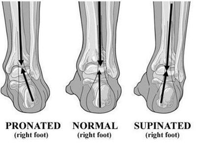 More about pronation of the foot