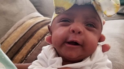 World's tiniest surviving baby born in California