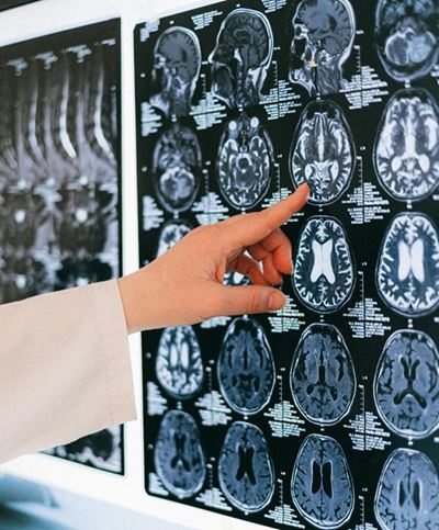 Examining Parkinson's disease
