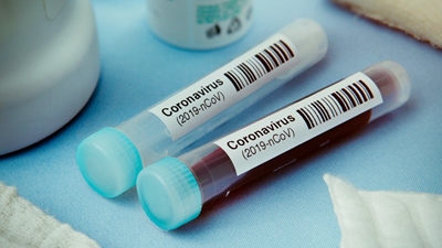 446 Confirmed Covid-19 cases in Western Cape