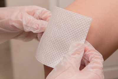 How to treat minor burns at home