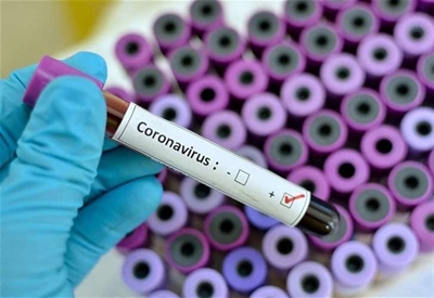 SA records uptick in Covid-19 cases