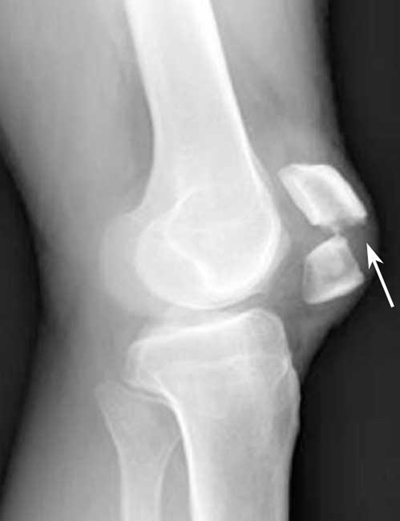 Different types of injuries